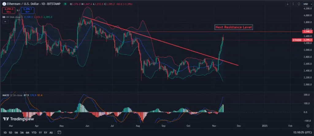 ETH/USDT 1D Chart – Source: TradingView