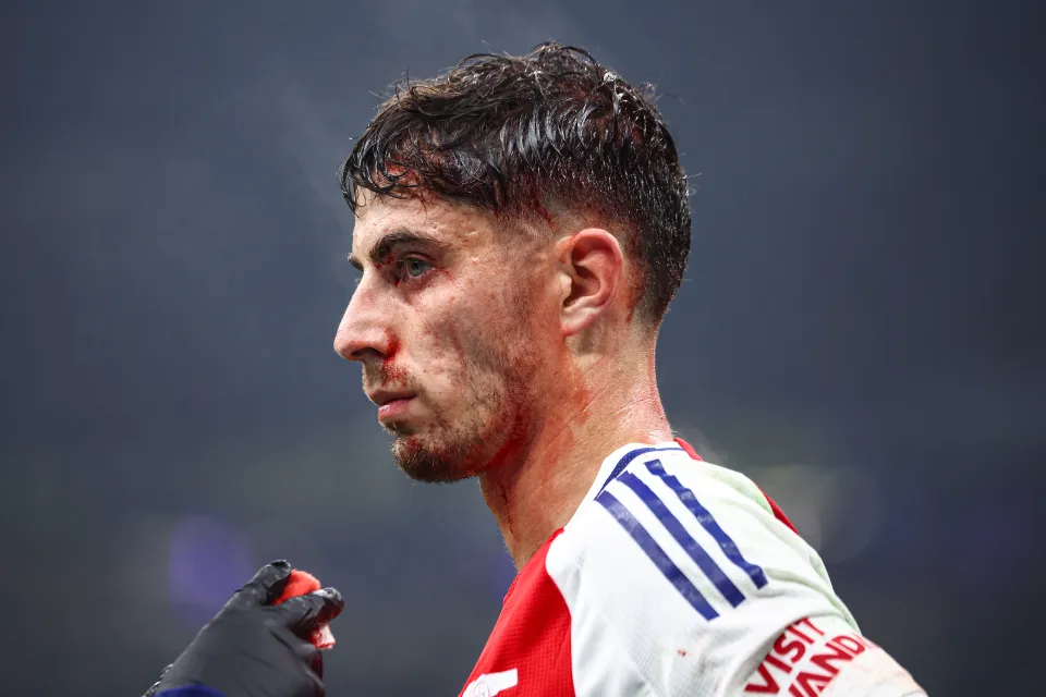Havertz bê bết máu sau cú va chạm ở đầu